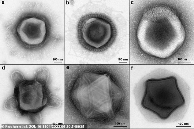 The newly discovered giant viruses exhibited tentacle-like 'electron-dense inner tube' appendages, 'icosahedral' protein shells shaped like 20-sided dice, 'star' designs, and other unusual shapes whose biological purposes are still unknown