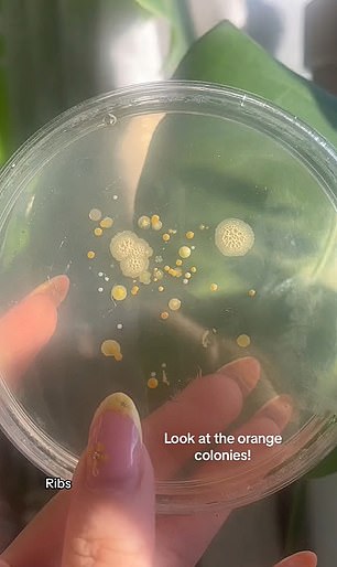 Dadurch entstanden einige kleine Bakterienkolonien
