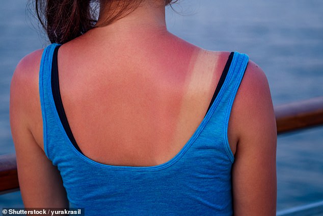 Experten warnen, je öfter man einen Sonnenbrand erleidet, desto höher ist das Risiko, an Melanom-Hautkrebs zu erkranken