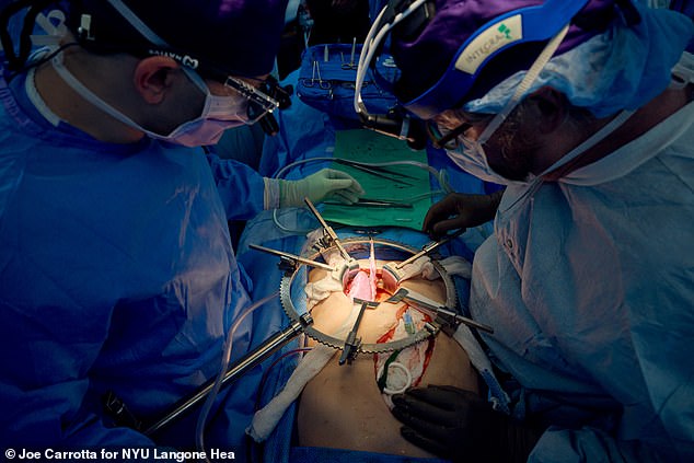 Jeffrey Stern (links) und Robert Montgomery (rechts) untersuchen die Schweineniere, kurz nachdem die Durchblutung des Organs am 14. Juli wiederhergestellt ist