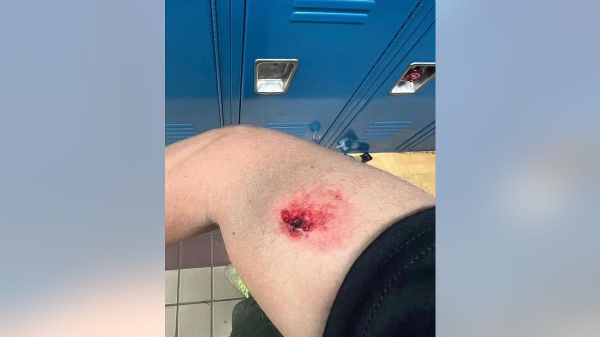 Ein Grenzschutzbeamter zeigt in einer Umkleidekabine eine blutige Verletzung an seinem Bein