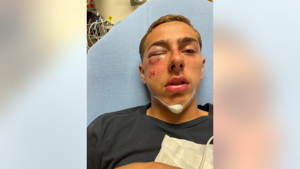Verletzungen, die ein 15-Jähriger während des mutmaßlichen Angriffs eines Staatspolizisten erlitten hat