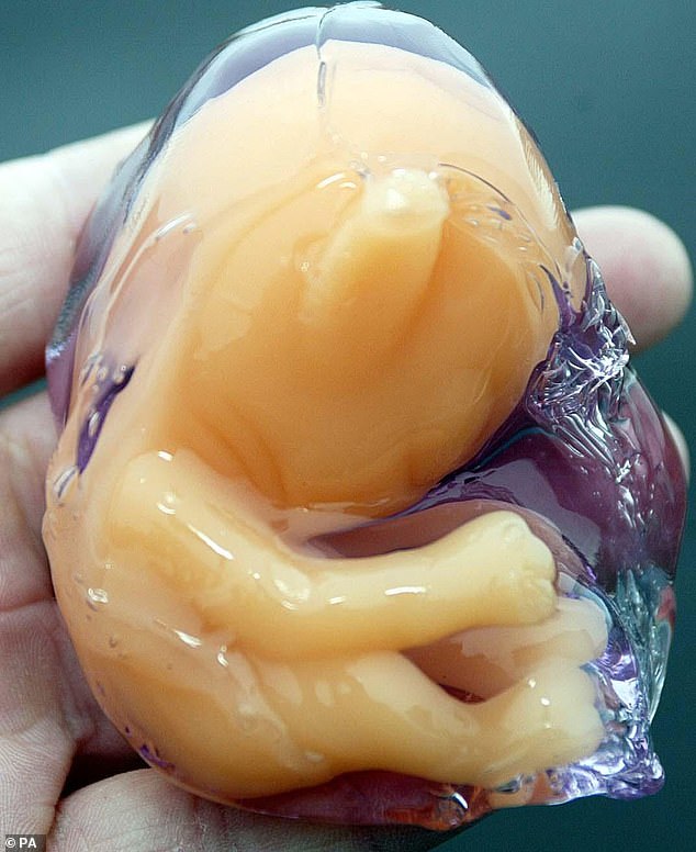 Back in 2004, a major police alert was sparked following the discovery of a potential alien-like 'foetus' in the back garden of a home in County Durham. It turned out that the object was in fact a Scardox alien toy