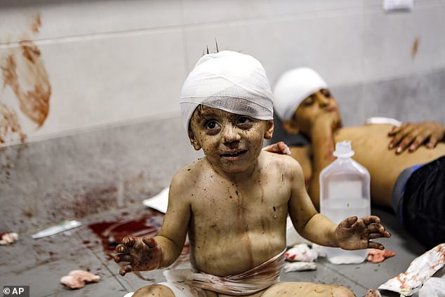 Wounded Palestinian children lay at the al-Shifa hospital, following a blast there on Tuesday