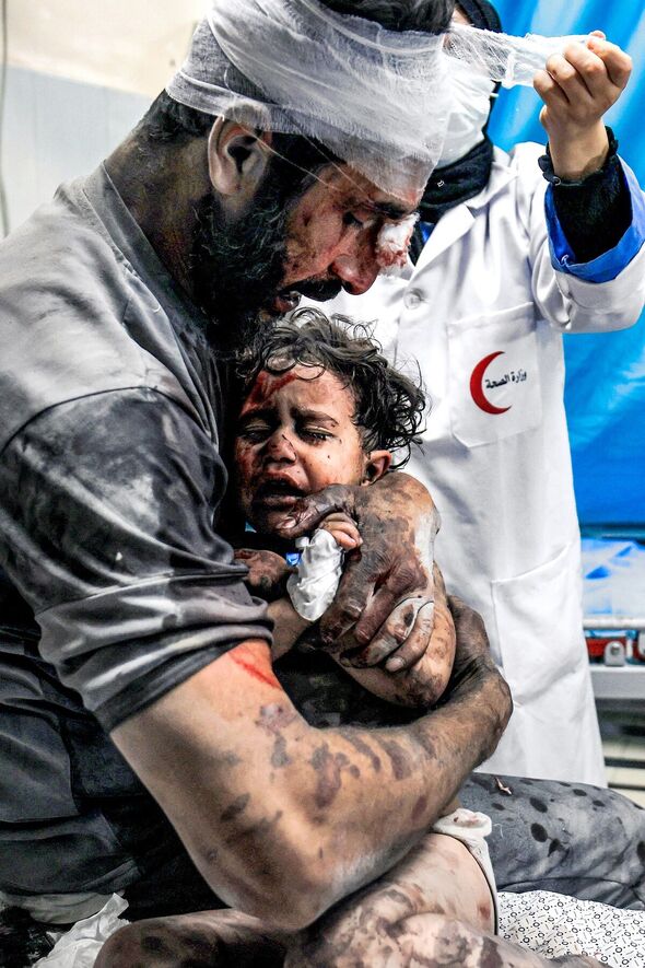 Ein palästinensischer Vater tröstet sein verletztes Kind 