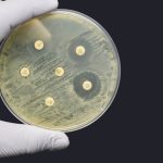Bekämpfung antimikrobieller Resistenzen: Neue Studie zielt auf Bakterien ab, während Forscher die EU auffordern, mehr zu tun