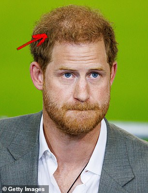 Dr Motykie said the Prince, 39 and pictured above in 2022, had likely used fillers to help obscure his thinning hairline