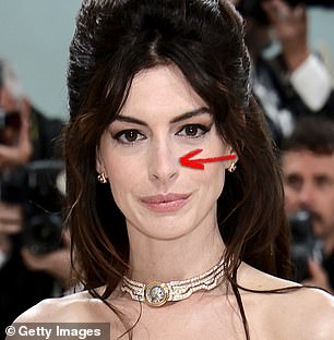 The 40-year-old Les Miserables actress appears to have had surgery on her nose, said Dr Motykie.