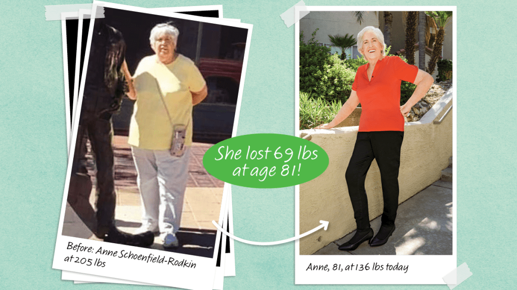 Vorher-Nachher-Fotos von Anne Rodkin, die im Alter von 81 Jahren mit Hilfe von Proteinnudeln zur Gewichtsreduktion 30 kg abgenommen hat