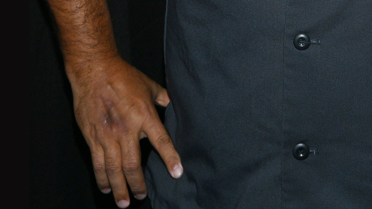 Eine Nahaufnahme der verletzten Hand von Buddy Valastro