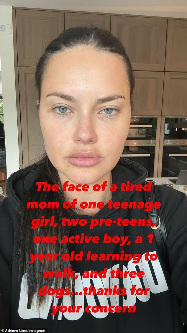 Ihre Seite: Nach Online-Diskussionen über ihr Aussehen brach das Supermodel auf Instagram ihr Schweigen zu den Gerüchten über Schönheitsoperationen