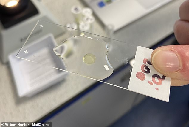 This small disk is the base of a 'living plaster' that can grow into a real intestinal wall to treat lesions and damage which the body cannot heal