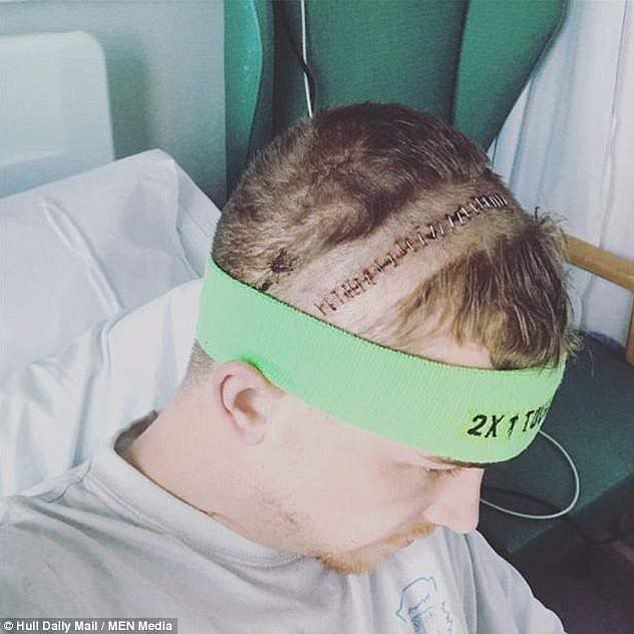 Nach der Diagnose im Januar 2018 wurde sein Tumor zwei Monate später entfernt, was eine ganz neue Tortur mit sich brachte, da er wach sein musste, während er unter dem Messer lag