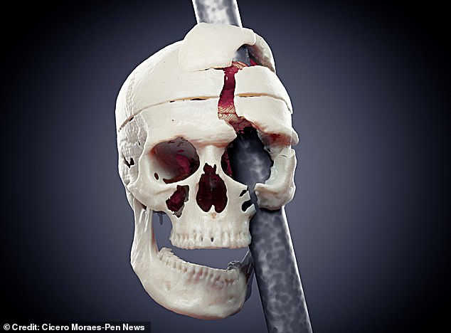 Wissenschaftler können das Gesicht einer Person anhand ihres Schädels nachbilden, indem sie mithilfe von Daten, die von lebenden Menschen gespendet wurden, die wahrscheinliche Tiefe der Haut an verschiedenen Stellen des Kopfes ermitteln