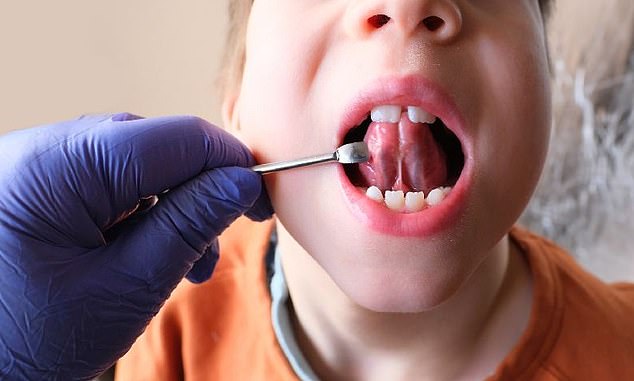Zahnärzte, die den Eingriff durchführen, verwenden normalerweise einen Laser, um die überschüssige Haut zu durchtrennen, die die Zunge mit dem Mundboden verbindet