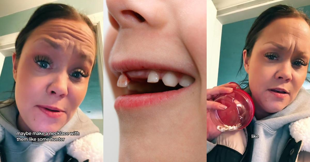 Warum behalten Eltern die Zähne ihrer Kinder?  Mutter stellt bizarre Praktiken in Frage