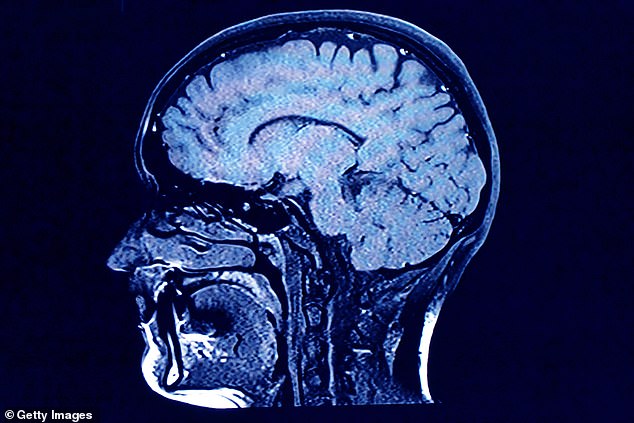 Wissenschaftler haben herausgefunden, dass das menschliche Gehirn grundlegend anders und effizienter arbeitet als die KI (Archivbild)