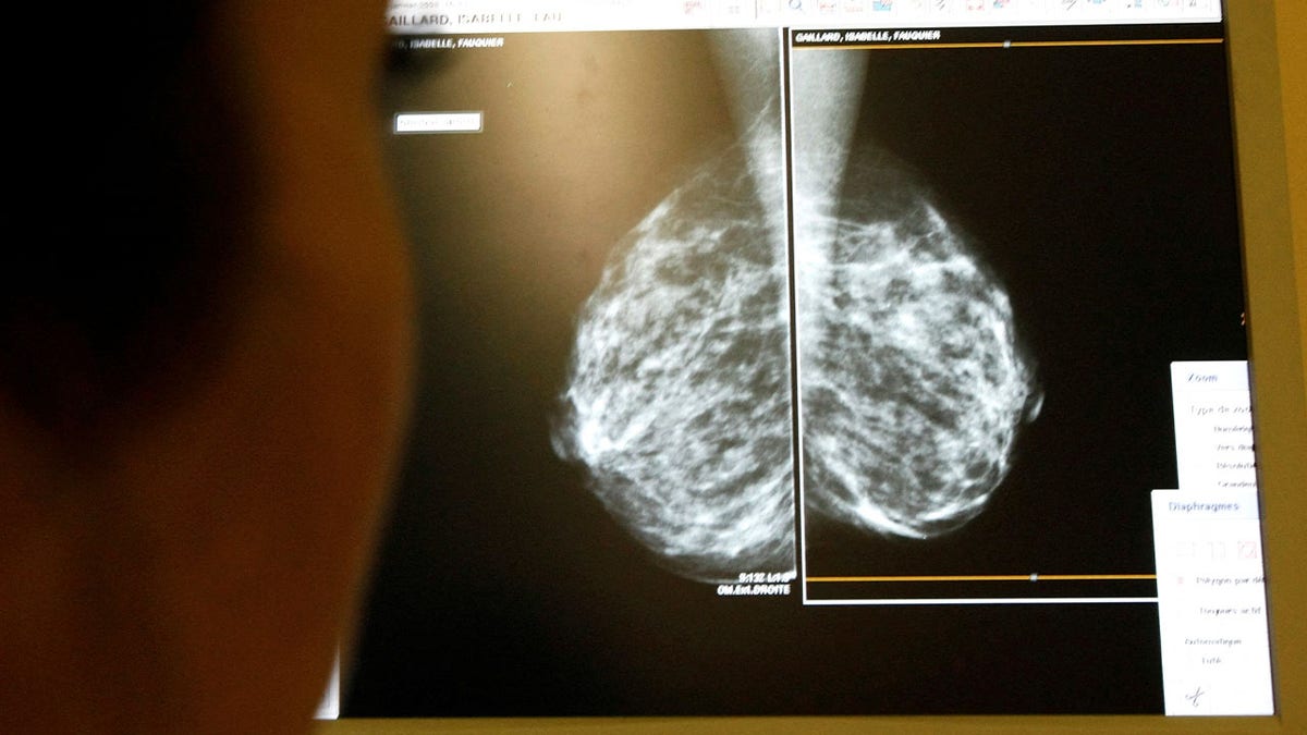 Ein Brustkrebs-Screening