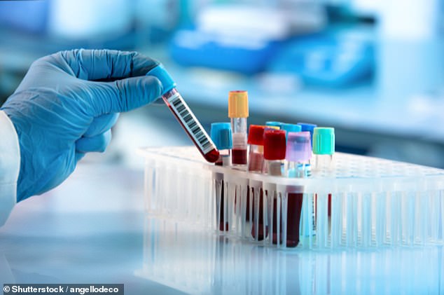 Der neue Bluttest sucht nach zirkulierenden Fragmenten der Krebs-DNA.  Niedrigere Werte bedeuten, dass der Krebs kleiner wird und die Behandlung anschlägt.  Ein höherer Wert zeigt an, dass die Behandlung nicht funktioniert