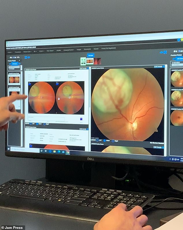 Ärzte fanden einen großen Tumor im linken Auge von Frau Levine, der dazu geführt hat, dass sie etwa die Hälfte ihres Sehvermögens verloren hat