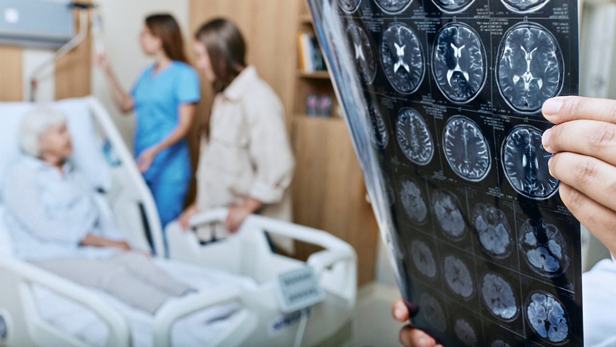 Alzheimer-Patient – ​​Gehirnscans