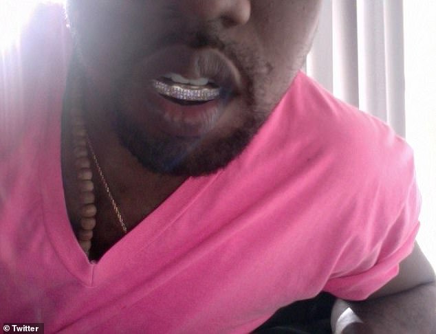 Kanye hat schon früher einen Grill getragen und in den sozialen Medien ein mit Diamanten besetztes Set auf seiner unteren Zahnreihe zur Schau gestellt