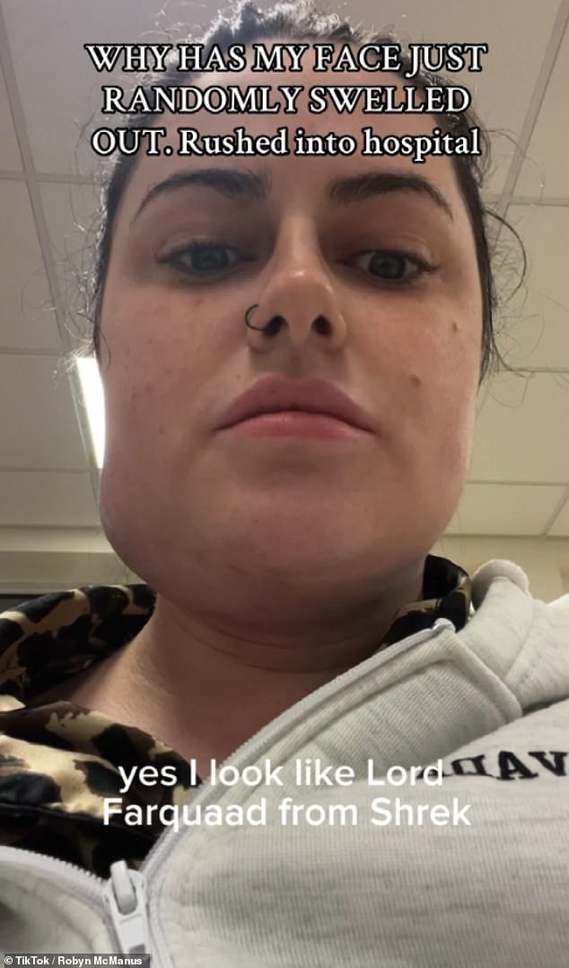 Influencerin Robyn McManus im Bild nach ihrer zweiten Operation – bei der ihr Gesicht aufgrund eines Hämatoms unkontrolliert anschwoll