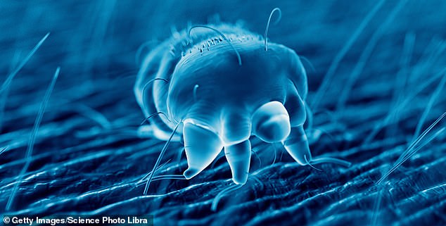 The mites, which are not visible to the naked eye, burrow into the skin and lay eggs, which then hatch