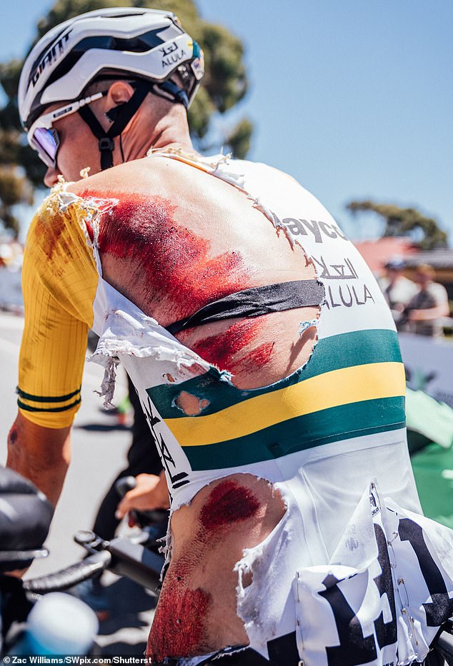 Der australische Fahrer Luke Plapp musste die Tour Down Under abbrechen, nachdem er bei einer Abfahrt mit 100 km/h einen heftigen Unfall auf der Straße erlitten hatte