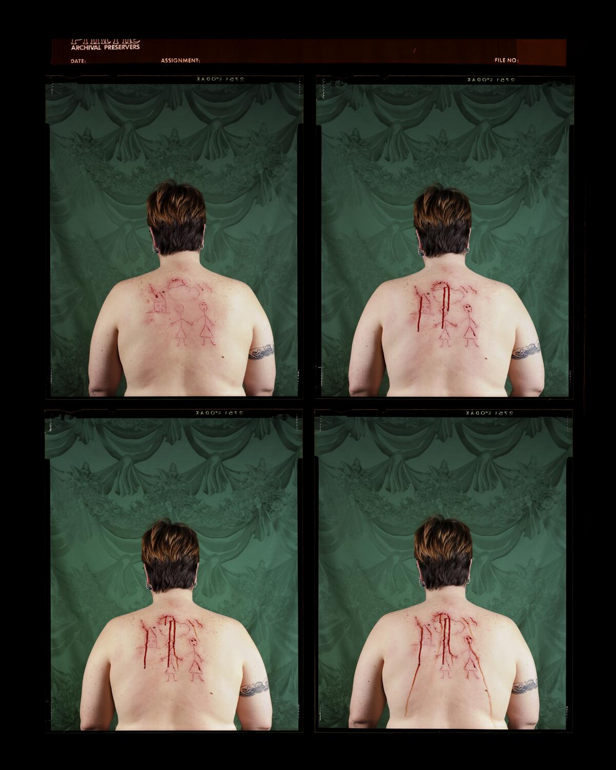 Ein Kontaktabzug zeigt vier Bilder des blutigen Rückens einer Frau.