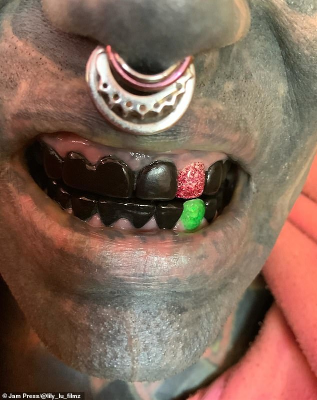 Lily hat sich die Zunge spalten lassen und sich im Zuge einer Reihe extremer Körpermodifikationen schwarze Zähne aus Keramik einsetzen lassen