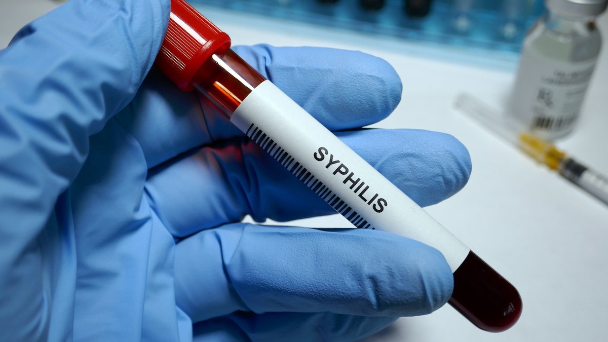 Blutfläschchen mit Syphilis