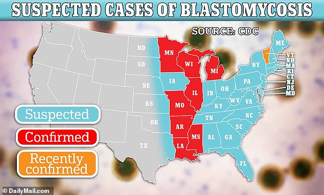 Die obige Karte zeigt Bundesstaaten, in denen Blastomykose-Fälle bestätigt wurden (rot), kürzlich bestätigt wurden (orange) oder bei denen der Verdacht besteht, dass sie auftreten (blau).