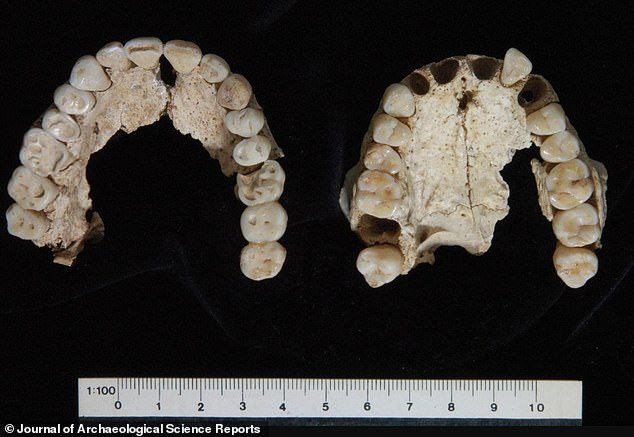Zähne aus Grab I: Der linke ist ein „robuster erwachsener Mann mittleren Alters“ und der rechte ist eine junge erwachsene Frau.  Grab I enthält auch die Überreste einer Frau und eines Babys, bei denen es sich den Forschern zufolge um die Frau Philipps II., Kleopatra, und ihr neugeborenes Kind handelt