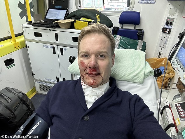 Durch den Unfall war er angeschlagen und hatte blaue Flecken im Gesicht, aber glücklicherweise hatte Dan das Glück, schwere Verletzungen zu vermeiden
