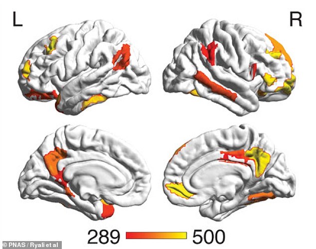 Dieses Bild aus der neuen Studie zeigt, welche Teile des Gehirns für die Unterscheidung zwischen Männern und Frauen am wichtigsten sind: das Striatum und Bereiche, die am Standardmodus-Netzwerk und dem limbischen Netzwerk beteiligt sind