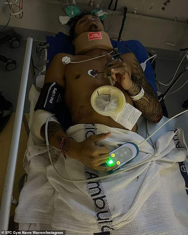 Harley Robinson, 25, wurde bei einem mutmaßlichen Gewaltvorfall im Straßenverkehr von seinem Fahrrad geschleudert.  Er ist im Krankenhaus auf dem Weg zur Genesung abgebildet