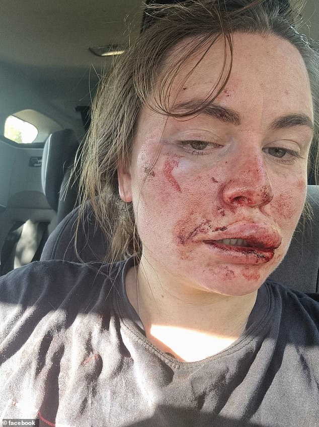 Frau Austin veröffentlichte Fotos von sich selbst vor und nach dem Angriff durch einen Mann mit einem an einen Stock gebundenen Stein, fast ein Jahr bevor Samantha Murphy am Sonntag in der Nähe verschwand