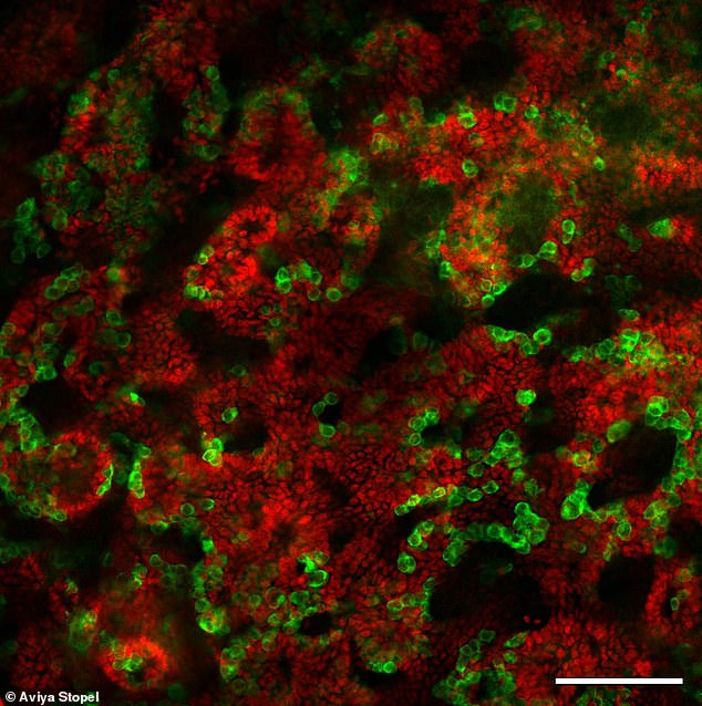 Diese Hodenorganoide wurden aus Zellen von Mäusejungen gezüchtet und 21 Tage lang in einer Schale inkubiert.  Sertoli-Zellen (rot) sind für die Bildung der Tubuli im Hoden verantwortlich.  Keimzellen (grün) produzieren die Samenzellen.