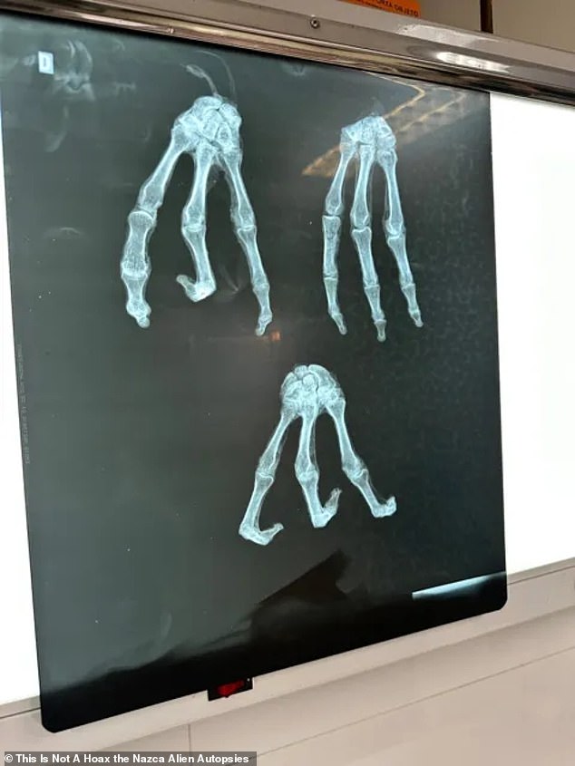 Bisher berichten die Filmemacher, dass sie Röntgenaufnahmen (oben), DNA und andere Laboruntersuchungen an einem der scheinbar mumifizierten Körper durchführen ließen, die in Zusammenarbeit mit Wissenschaftlern aus den Vereinigten Staaten vor Ort in Mexiko und Peru gefilmt wurden