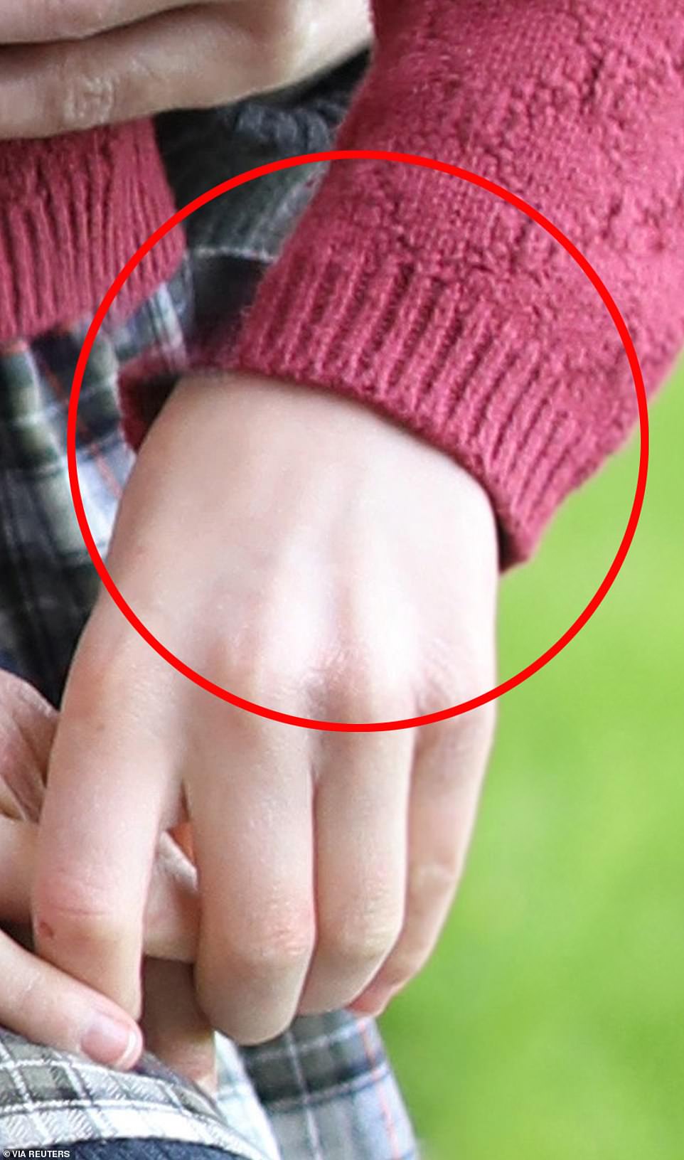It appears Charlotte's hand was copied over from another picture as there is an empty space where her sleeve should be
