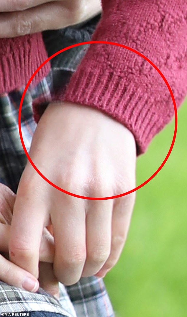 Some of the edits may have included Charlotte's hand which looks like it was copied over from another picture as there is an empty space where her sleeve should be