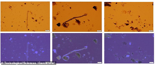 Diese lichtmikroskopischen Bilder zeigen Mikroplastik in Proben menschlicher Plazenta.  Die untere Reihe wird mit UV-Licht beleuchtet, um zu zeigen, wie viel Kunststoff noch in der Probe vorhanden ist, auch nachdem das Gewebe verarbeitet wurde