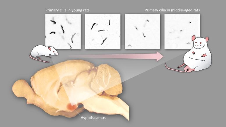 MC4R+-Zilien im Gehirn von Ratten verkürzen sich mit zunehmendem Alter