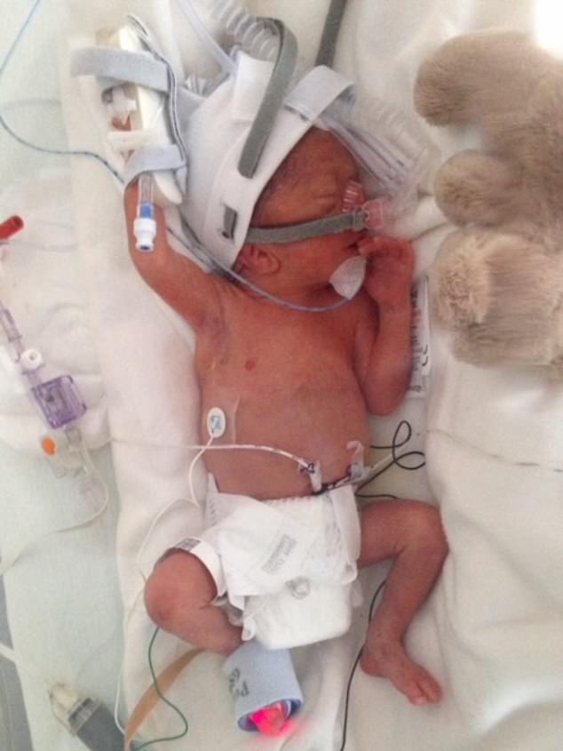 Arthur wurde im Alter von 26 Wochen zu früh geboren und vor seinem dritten Geburtstag wurde bei ihm ein Gehirntumor diagnostiziert