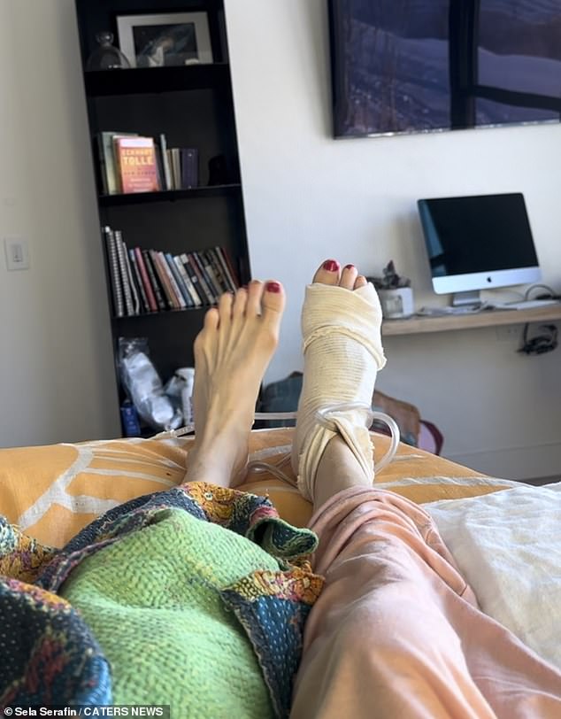 Frau Serafins Füße nach ihren Operationen