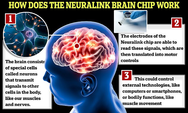 Der Neuralink-Chip führt sehr feine Drähte in Teile des Gehirns ein, um dessen Aktivität zu messen.  Das Gerät sendet diese Signale dann an Computer, sodass der Patient sie aus der Ferne steuern kann