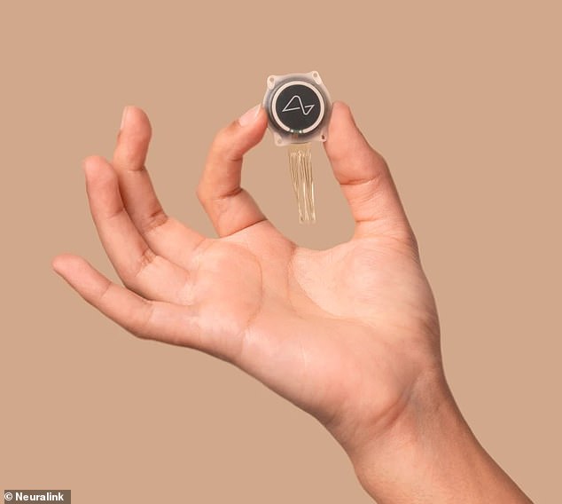 Der Neuralink-Chip (im Bild) ist im Vergleich zu früheren Gehirn-Computer-Schnittstellengeräten recht klein, muss aber trotzdem chirurgisch implantiert werden