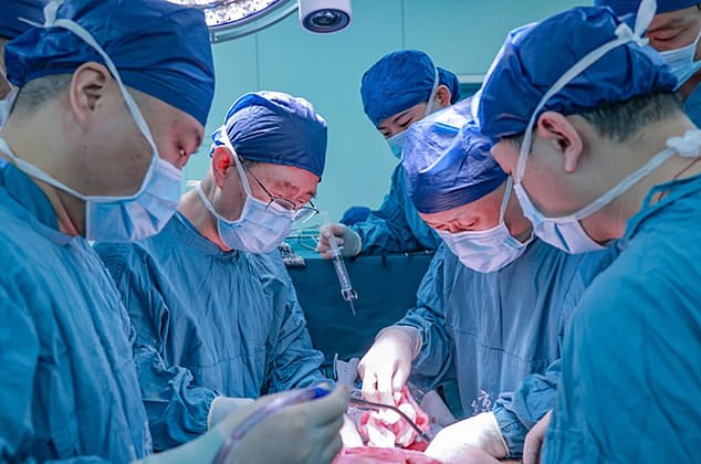 Das obige Bild zeigt Chirurgen in China, die daran arbeiten, eine genetisch veränderte Schweineleber in einen Menschen zu transplantieren