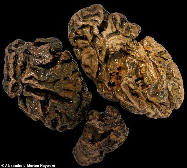 Gehirnfragmente einer Person, die vor etwa 200 Jahren auf einem viktorianischen Arbeitsfriedhof in Bristol, Großbritannien, begraben wurde.  Unter den Knochen, die aus dem stark durchnässten Grab ausgebaggert wurden, blieb kein anderes Weichgewebe erhalten.